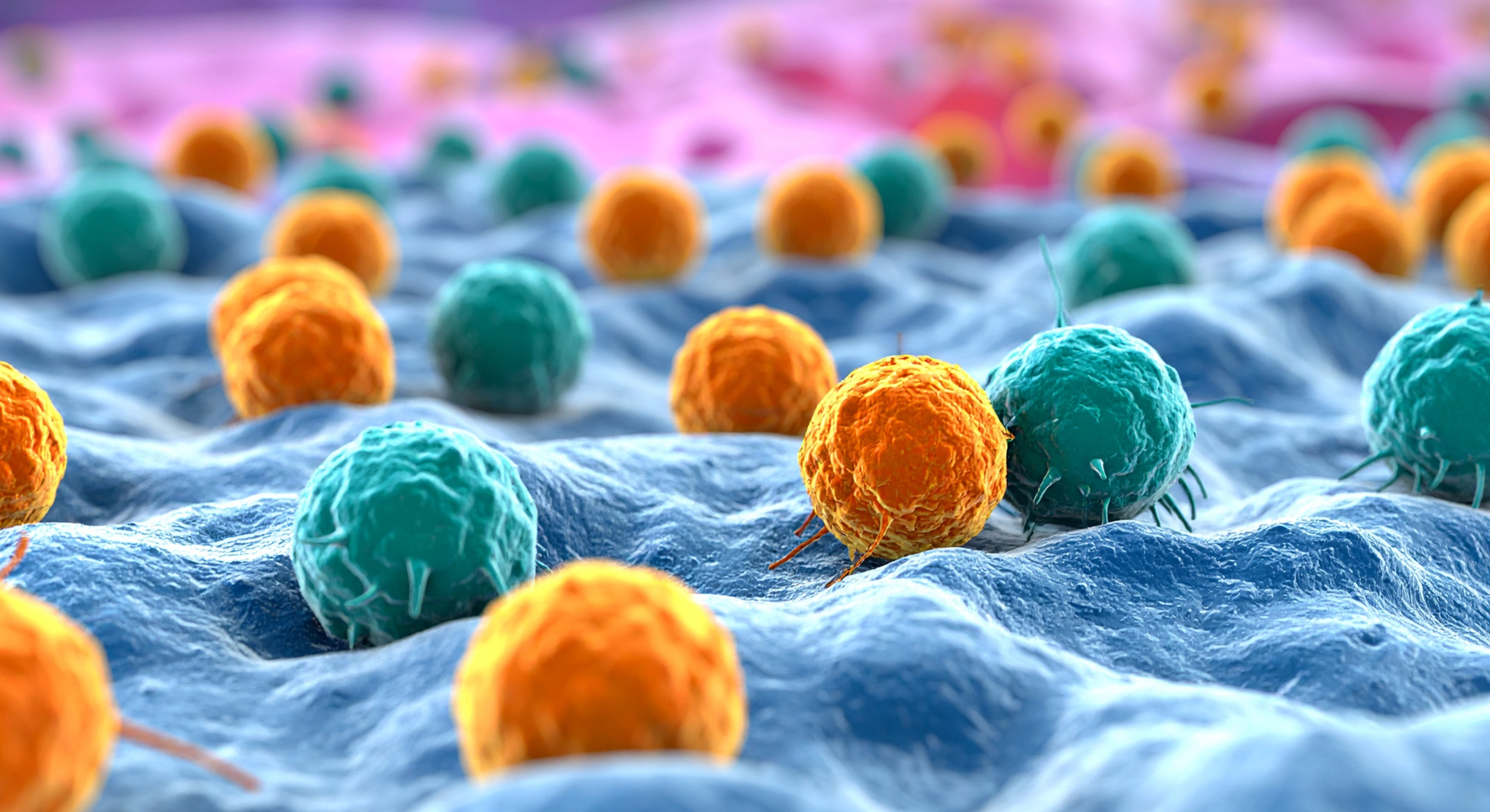 Immune-Related GI Adverse Events