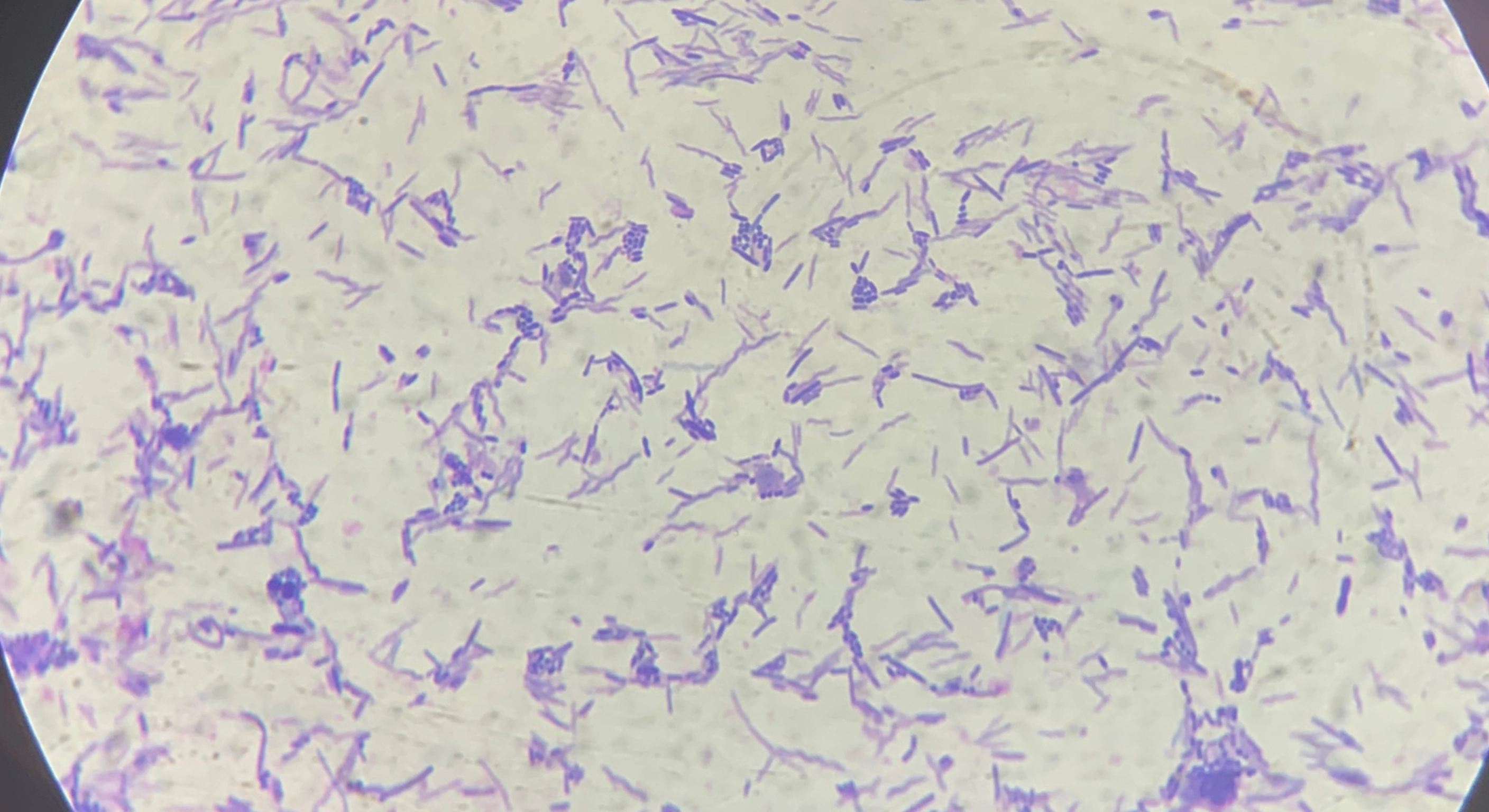 Chronic Diarrheal and Microscopic Colitis Syndromes